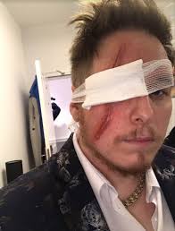 Lucky 'Underdog' teenagers work