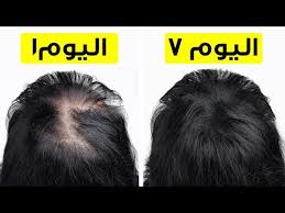 تجربتي مع زيت فيفيدول موسوعة الازاهير