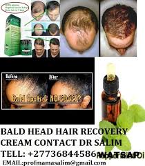 Bald Head Hair Recovery Cream 27736844586 Hair Cream For Bald Heads Works Within 7 10 Days You Simply Have To Smoothly Rub Hair Loss Stop Hair Loss Lost Hair