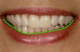 A crooked smile can cause dental problems that impact the health of your mouth. Evaluating Lip Symmetry In Facial Esthetics Spear Education