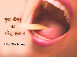 A painless lump in the breast, a it is diagnosed by pap test. à¤® à¤– à¤• à¤¸à¤° à¤• à¤‡à¤² à¤œ à¤µ à¤¨ à¤¸ à¤– Mouth Cancer Treatment In Hindi