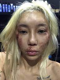 She is also a pageant contestant with more than 20 titles, both state and world. Dj Leng Yein Posts Horrific Photos Alleging Abuse At The Hands Of Her Boyfriend Over Two Years Coconuts Kl