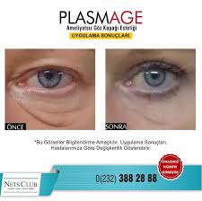 Goz Kapagi Estetigi Saglikli Gorme Alani Yakalamak Icin Goz Ust Kapaginda Sarkan Fazla Deri Fazlasinin Ve Yag Dokusu Fazlasinin Anti Aging Protection Skin
