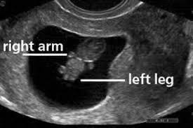 Pin On Ultrasound
