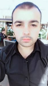 05 11 18 Estemylife 3000 Greft Sac Ekimi Hasan Akil