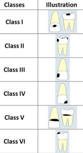 Dental Charting Dental Index Jr Online Dental Tutor