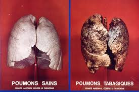 Résultat de recherche d'images pour "image de cigarette maladie"