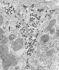 As many as nine in 10 people with the virus die as a result of the infection. Marburgvirus An Overview Sciencedirect Topics