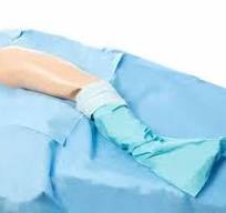 Custom Disposable Hospital Medical Sterile Surgical Leg O ...