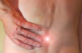 Arsura retrosternala este un simptom frecvent in boala de reflux gastroesofagian (brge), denumita si reflux acid. Durere De Spate Tipuri Cauze Si Tratamente