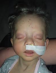 PLEASE JOIN US IN PRAYING FOR THIS CHILD...