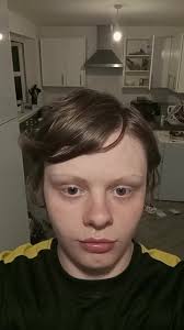 Ireland Ice Bucket Challenge Callum Ball