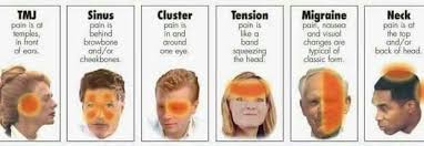 Different Headaches Types Of Headaches Chart Different Headaches Headache Types