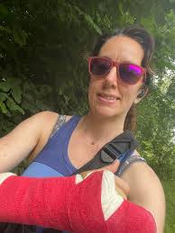 What is the recovery time for a wrist fracture and how long until I can  ride at a competition level again?