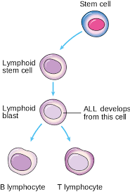 Acute Lymphoblastic Leukemia Acute Lymphoblastic Leukemia Leukemia Leukemia Awareness