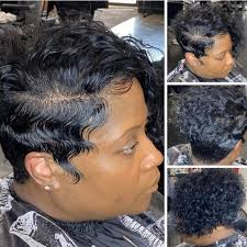 Hairloss/ Alopecia braids& hairstyles