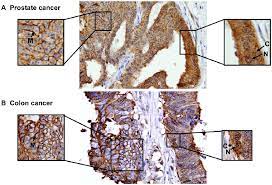 In fact, most people don't even know what it does. Immunohistochemical Analysis Of Ep Icd Expression In Prostate And Colon Download Scientific Diagram