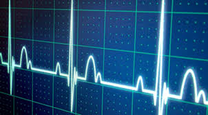 A dog's heart rate may increase for a variety of reasons, ranging from excitement or agitation to physical exertion. What Do You Know About Your Heartbeat