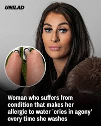 She now wants to find a cure 😲