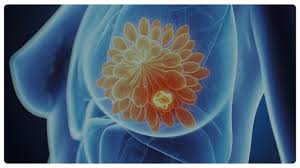 E is the name of a project created by three biggies of boston's indie community, thalia zedek (come, uzi, live skull), jason sanford (neptune) and gavin mccarth 🙌 awesome, you're subscribed! Coronavirus Tumore Al Seno Cosa Fare Con La Terapia Ormonale Fondazione Umberto Veronesi