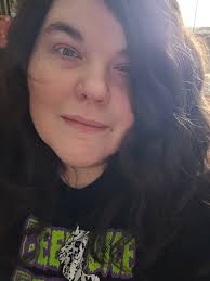 Is there anyone who was diagnosed with TM caused by a vaccine and it never  turned into anything more? I see a lot of people who say they were  diagnosed with TM