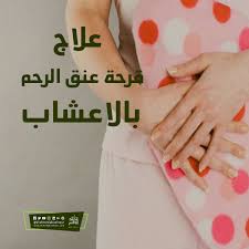 4 اعشاب لعلاج قرحة عنق الرحم تعرف عليها الان