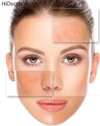 تصویر مرتبط