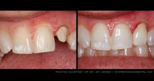 Pin On Cosmetic Dentistry