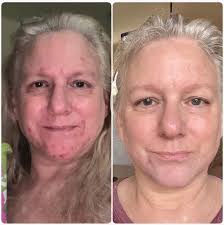 Finding healing in the truth that set her free. 🎨 😿 🎆 😑 💧  #MaternalLieExposed #MaternalRevelationsHere