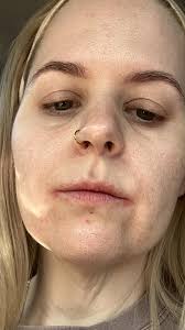 Plus, the dermatologist-approved lip balms to reach for instead. (via Shop  TODAY)