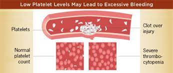 Chemotherapy.com | Managing Side Effects: Thrombocytopenia