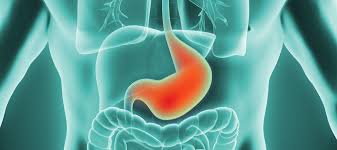 It is rare in people under 50 years of age and affects more men than women. Stomach Cancer Gi Cancer Institute
