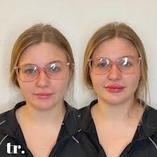 Sage • OKC Aesthetic Nurse Injector