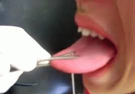 We did not find results for: Snake Eyes Piercing Der Stunde Kann Zunge Lahmen 20 Minuten
