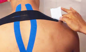 Cintas Kinesiologicas Para Lesiones En Espalda Y Cuello Cmd Sport
