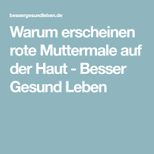 Wissenswertes Uber Rote Muttermale Und Wie Du Sie Behandeln Kannst Rote Muttermale Besser Gesund Leben Muttermal