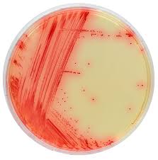 Image result for Mycoplasma