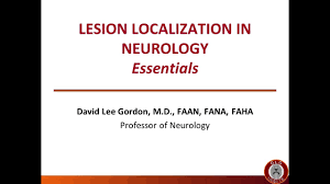 Image result for Neurologic Lesion Localization
