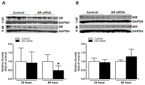 Its appearance is like a 1n4148. Ijms Free Full Text Repression Of The Glucocorticoid Receptor Aggravates Acute Ischemic Brain Injuries In Adult Mice Html