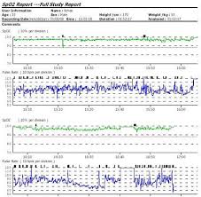 Finger Pulse Oximeter With Alarm And Perfusion Index Pi