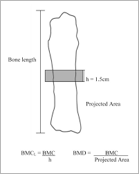 The thigh bone (femur) is a long bone. An In Vitro Animal Bone Model Study To Predict Spiral Fracture Strength Of Long Bones In The Young Infant Journal Of Clinical Orthopaedics Trauma
