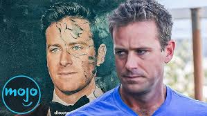 Armie Hammer Shaves His Head Backstage Before His Interview with Jimmy