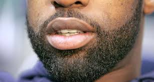 The hair in my face is getting ingrown really bad and has raised. How Black Men Should Grow Groom A Beard