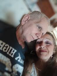 Hi sue brewin, it is with a very heavy heart that I have to tell that  Richard passed away two years ago last May . We were so close and I miss