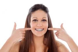 How often do you get your braces tightened. Foods To Eat After Getting Braces Tightened Bracify 3d Orthodontics
