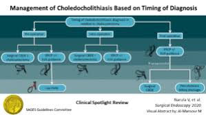 Image result for Choledocholithiasis