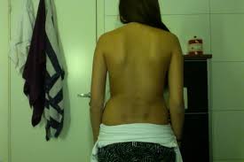 Vondt i korsryggen er vanlig og over 65% av befolkningen opplever dette noen gang i livet. Tcmn Therese Charlotte Side 76 En Av Norge S Storste Blogger