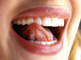 ˈaftə] (transliteration von altgriechisch ἄφθη, vom verb ἅπτω. Aphten Konnen Auf Vitamin Mangel Hinweisen Gesundheit