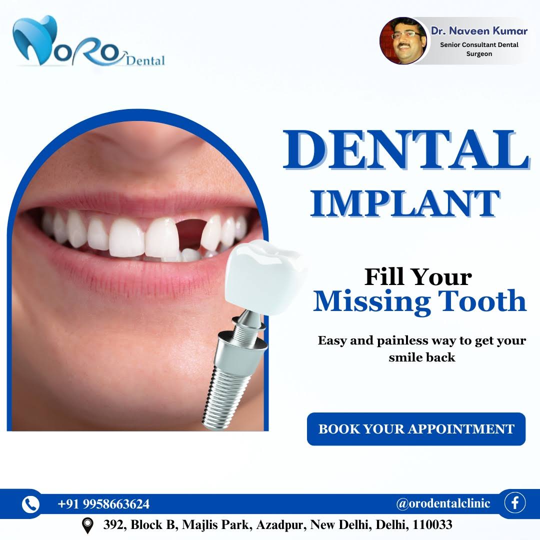 Dental Implant product image