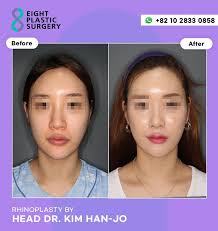 ❤️‍🔥Before & After